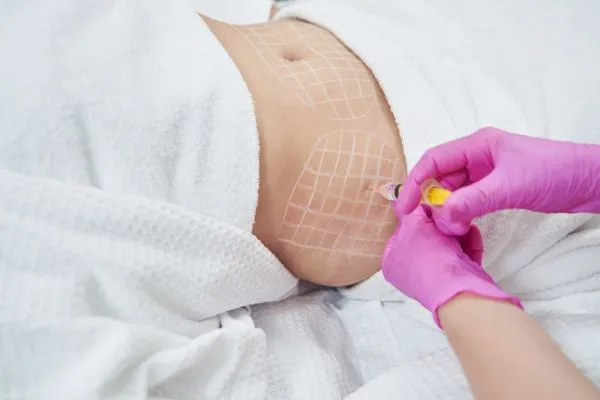 image of fat dissolving injections on love handles to help combat weight gain Twickenham