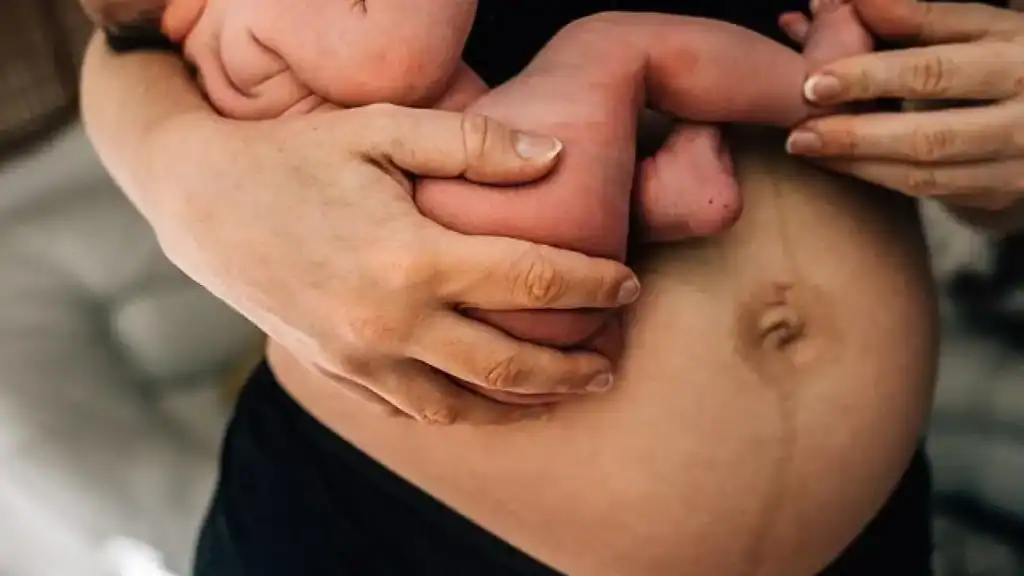 Why Is My Stomach Still Big After Pregnancy Twickenham?